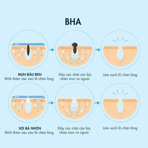 Tác động của BHA lên da trong việc trị mụn