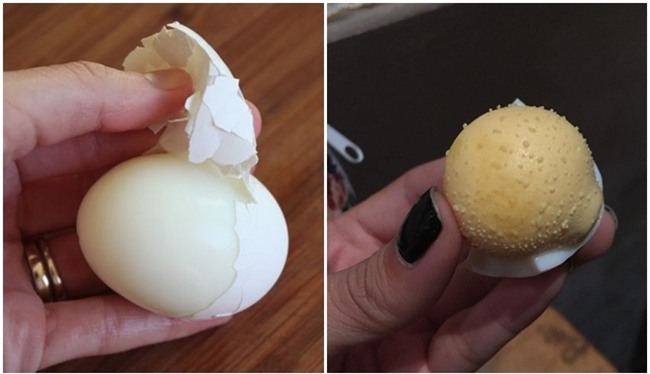 Cách trị mụn đầu đen bằng trứng gà luộc ở vùng mũi hiệu quả tại nhà