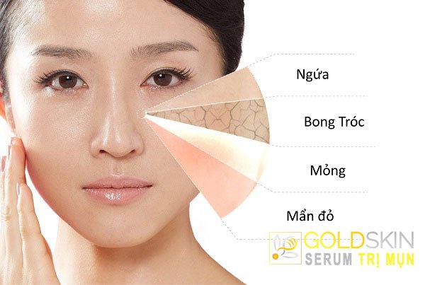Da mặt thường mỏng và nhạy cảm hơn các vùng da khác nên dễ dị ứng